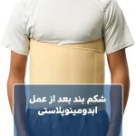 شکم بند بعد از عمل ابدومینوپلاستی