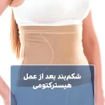 شکم‌بند بعد از عمل هیسترکتومی