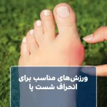 ورزش‌های مناسب برای انحراف شست پا