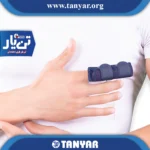 آتل انگشت کوتاه