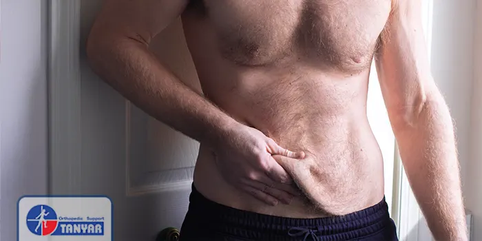 افتادگی شکم بر اثر کاهش وزن سریع