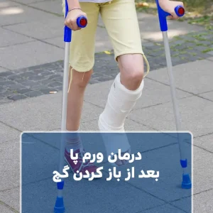 درمان ورم پا بعد از باز کردن گچ