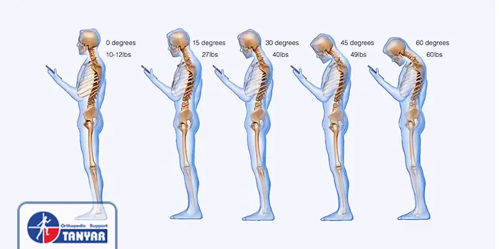 فشار بر روی گردن در زمان کار با مبایل در حالت های مختلف